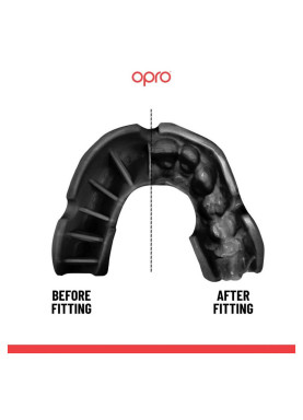 OPRO: Tandskydd SILVER - VIT